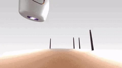 How does IPL work?